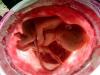 Foto del feto, foto dell'addome, ecografia e video sullo sviluppo del bambino Come si sviluppa il feto a 38 settimane di gravidanza