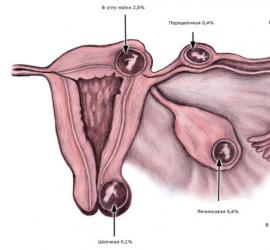 Извънматочна бременност: признаци и симптоми в ранните етапи
