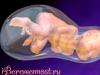 Kako izbija vodenjak kod trudnica i šta učiniti ako nema kontrakcija ili se pojave problemi
